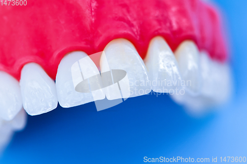 Image of Upper human jaw with teeth and gums anatomy model