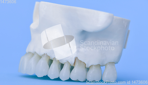 Image of Upper human jaw with teeth