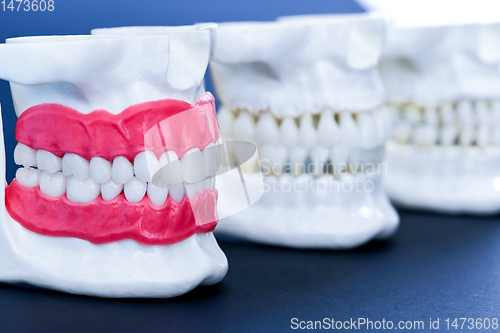 Image of Human jaws with teeth and gums anatomy models