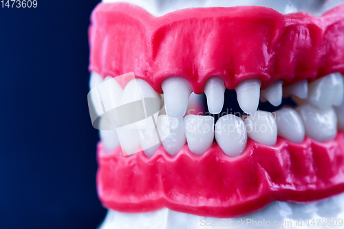 Image of Human jaw with teeth and gums anatomy model