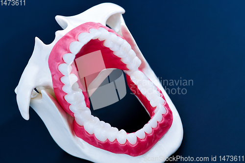 Image of Dentist orthodontic teeth model