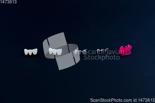 Image of different types of dental tooth crowns