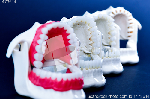 Image of Dentist orthodontic teeth models