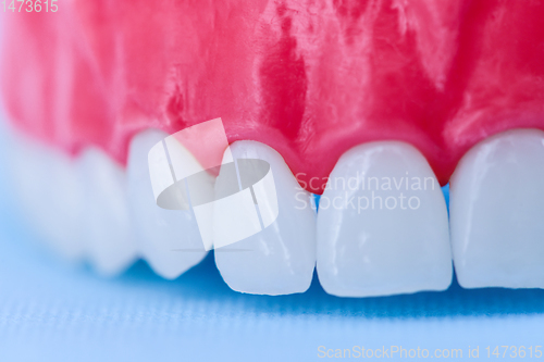 Image of Upper human jaw with teeth and gums anatomy model