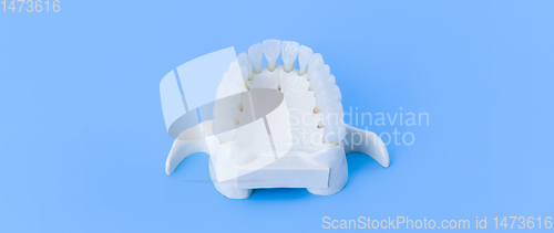 Image of Upper human jaw with teeth