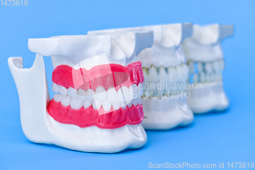 Image of Human jaws with teeth and gums anatomy models