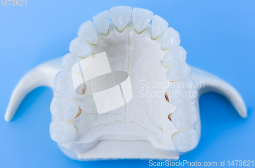 Image of Upper human jaw with teeth