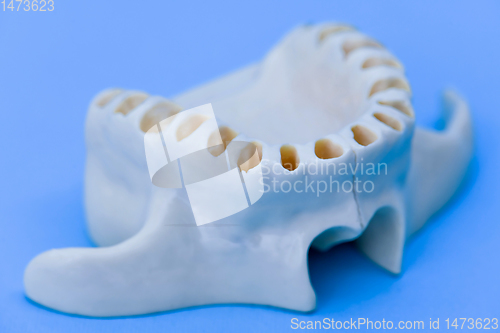 Image of Upper human jaw without teeth