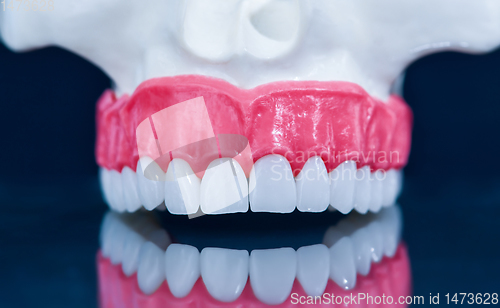 Image of Upper human jaw model with a reflection on the glass