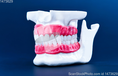 Image of Human jaw with teeth and gums anatomy model