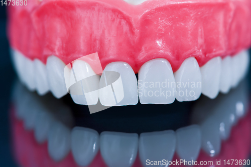 Image of Upper human jaw model with a reflection on the glass