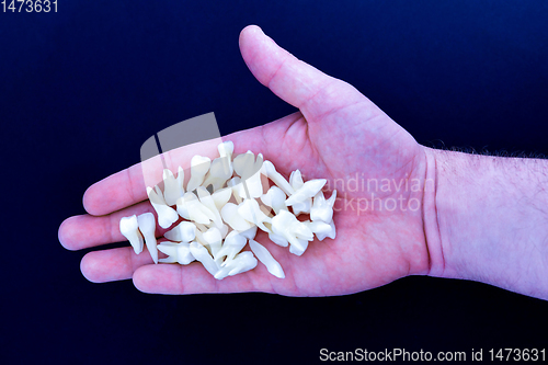 Image of human hand holding white teeth on blue background