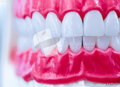 Image of Human jaw with teeth and gums anatomy model