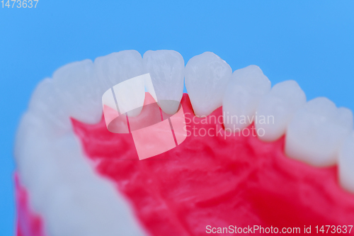 Image of Upper human jaw with teeth and gums anatomy model