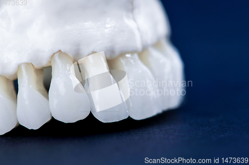 Image of Upper human jaw with teeth