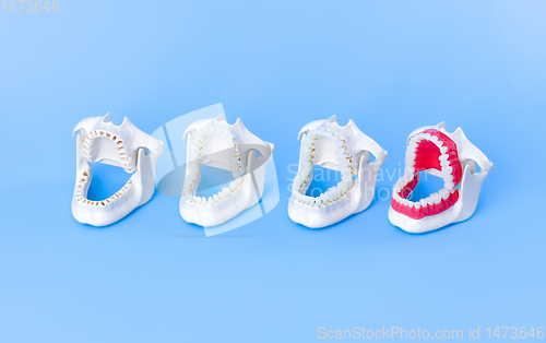 Image of Dentist orthodontic teeth models