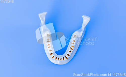 Image of Lower human jaw without teeth