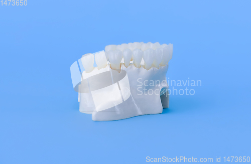 Image of Upper human jaw with teeth