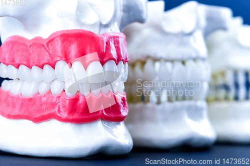 Image of Human jaws with teeth and gums anatomy models