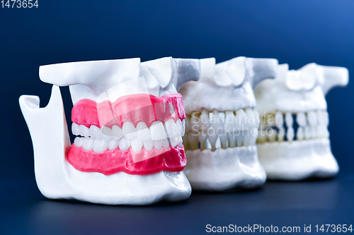 Image of Human jaws with teeth and gums anatomy models