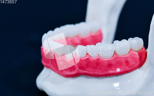 Image of Lower human jaw with teeth and gums anatomy model