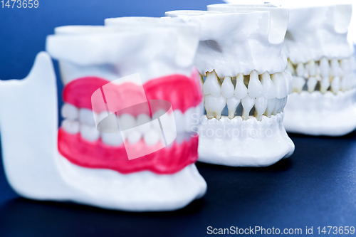 Image of Human jaws with teeth and gums anatomy models