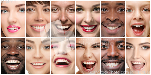 Image of Beautiful close up portraits, concept of teeth treatment