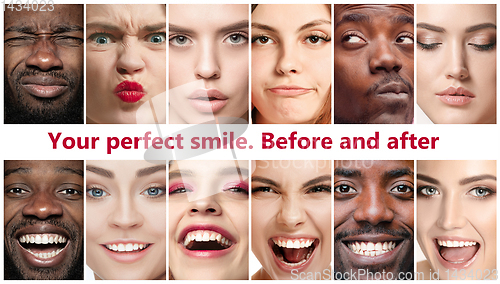 Image of Beautiful close up portraits, concept of teeth treatment