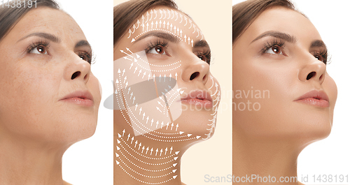 Image of Beautiful female face, concept of skincare and lifting