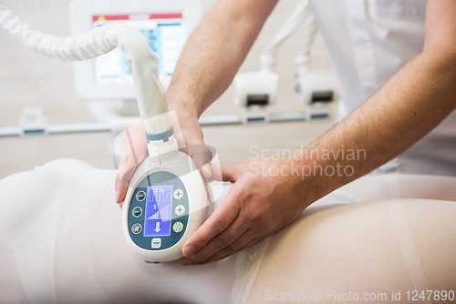 Image of Procedure laser lipolysis