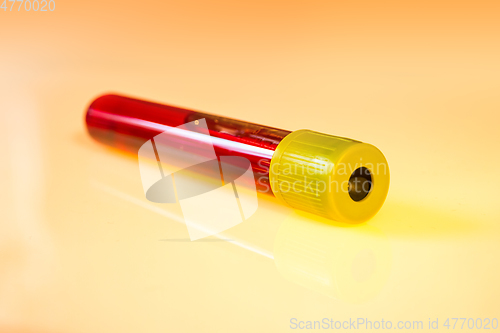 Image of Blood test tube