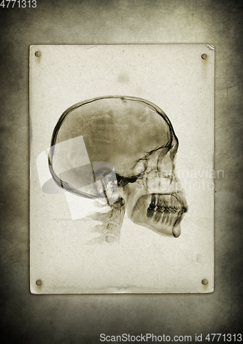 Image of X-ray skull on a vintage paper background