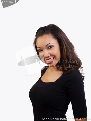 Image of Young black woman smiling with braces on upper teeth