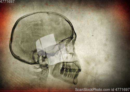 Image of X-ray skull on a dark textured background