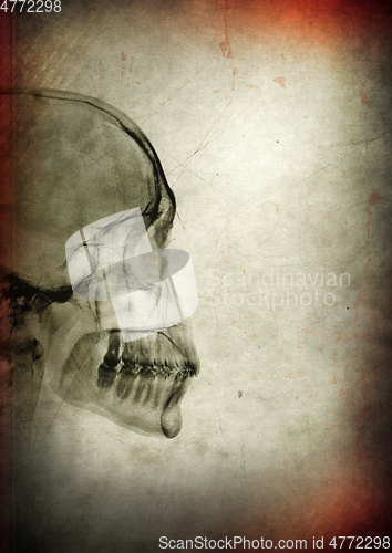 Image of X-ray skull on a dark textured background