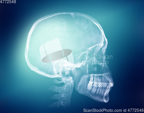 Image of Human skull X-ray image