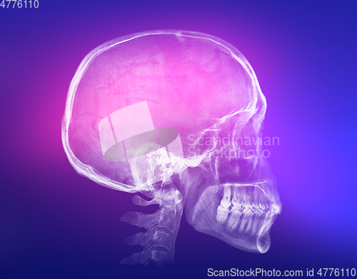 Image of Human skull X-ray image