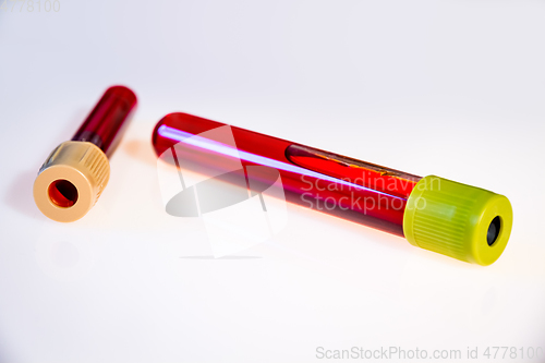 Image of Blood test tubes