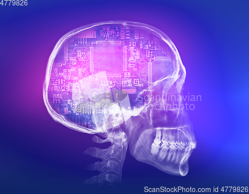 Image of Human skull X-ray image. Artificial intelligence concept