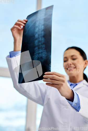 Image of happy female doctor with x-ray at hospital