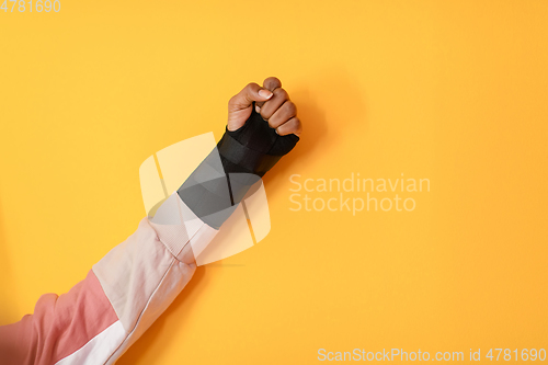 Image of hand injury. a female injured hand on a yellow background
