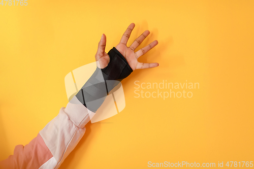 Image of hand injury. a female injured hand on a yellow background