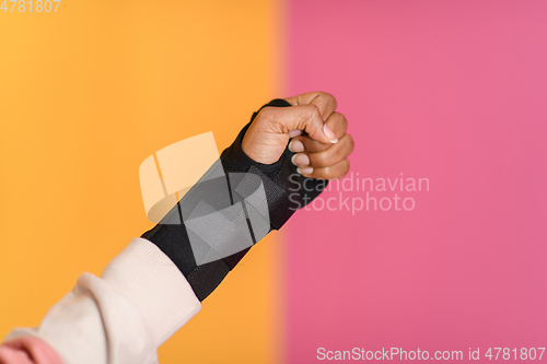 Image of hand injury. a female injured hand on a yellow background