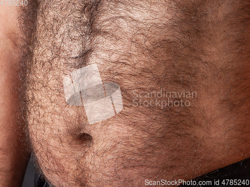 Image of big hairy belly