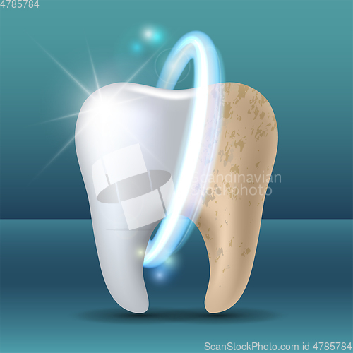 Image of Clean and dirty tooth before and after whitening