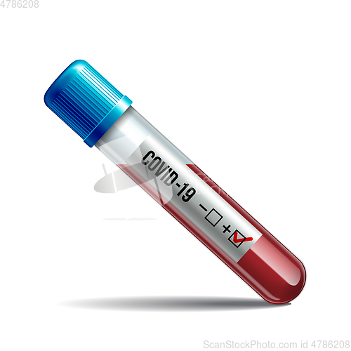 Image of Test tube with blood sample for COVID-19, Coronavirus test.