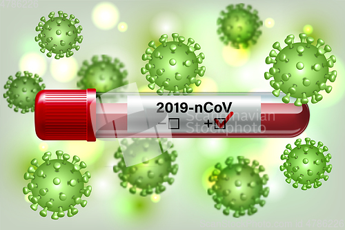 Image of Test tube with blood sample for COVID-19, Coronavirus test.