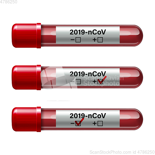 Image of Set of test tube with blood sample for COVID-19, Coronavirus test