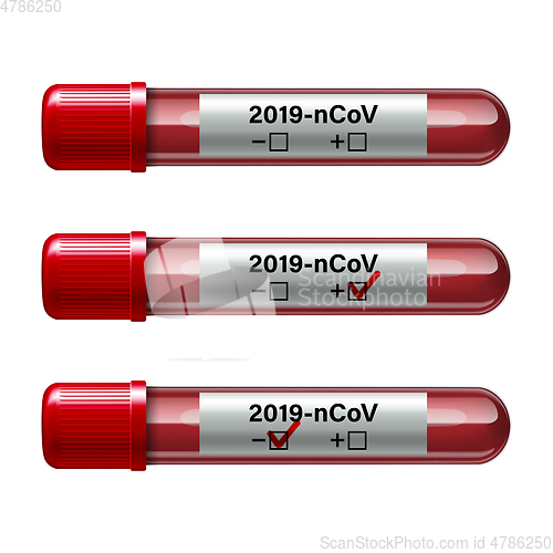 Image of Set of test tube with blood sample for COVID-19, Coronavirus test