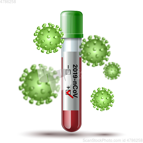 Image of Test tube with blood sample for COVID-19, Coronavirus test.